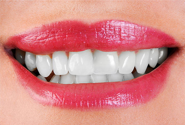 Teeth Whitening